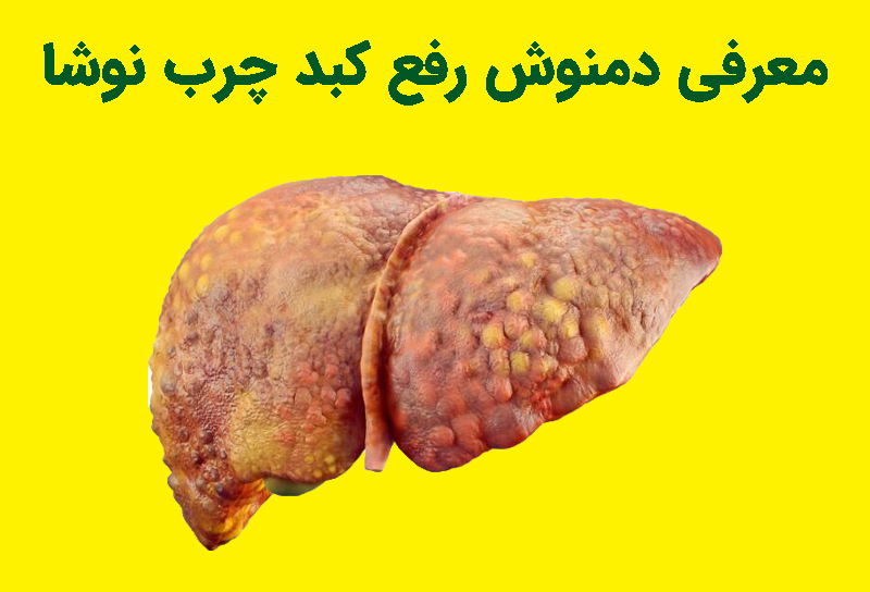 معرفی محصول دمنوش رفع کبد چرب نوشا برای پاکسازی کبد