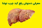 معرفی محصول دمنوش رفع کبد چرب نوشا برای پاکسازی کبد